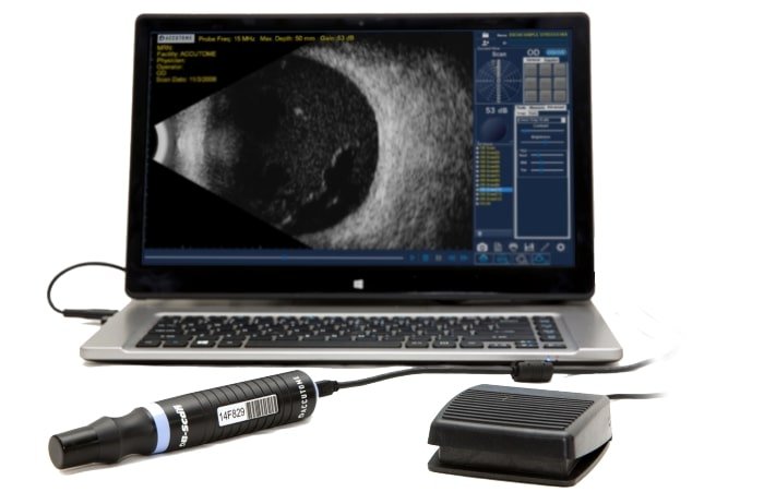 ophthalmic-bscan-export-B-scan